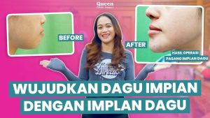 Ilustrasi anatomi wajah dan pengaruh dagu ganda terhadap metabolisme lemak tubuh.